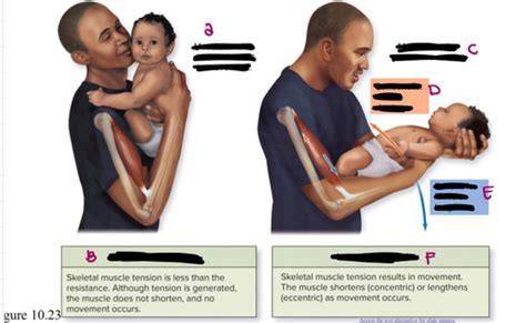 Isometric vs isotonic contraction Flashcards | Quizlet