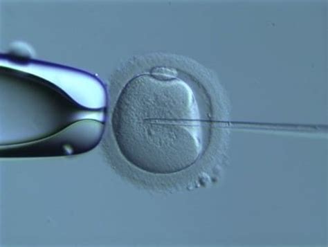 Ivf Vs Icsi Difference And Comparison