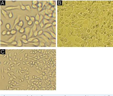 Figure 1 From Proteomic Analysis Of The Effect Of Extremely Low