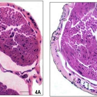 Photomicrograph Showing The Transverse Sections Of Left Sciatic Nerve