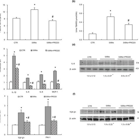 Analysis Of The Expression Levels Of Renal Oxidative Stress And