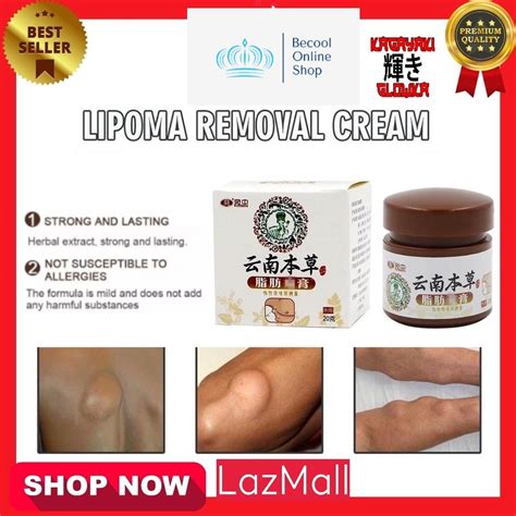 Lipoma Removal Herbal Ointment Tumor Treatment Multiple Anti