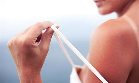 How To Treat Sunburn And How To Prevent Getting Sunburnt In The Future