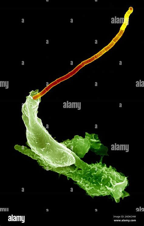 Neutrophils And Anthrax Bacteria Coloured Scanning Electron Micrograph Sem Of Neutrophil