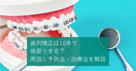 歯列矯正は10年で後戻りする？原因と予防法・治療法を解説 Hanaravi歯科矯正blog