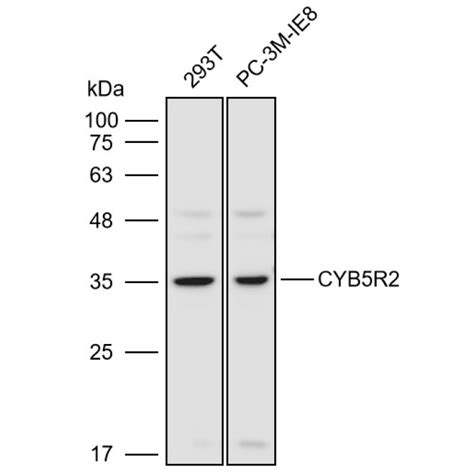 Solarbio K110939P Anti CYB5R2 Polyclonal Antibody 试剂仪器耗材