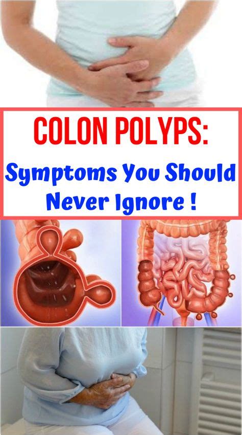 Colon Polyps Symptoms You Should Never Ignore Healthy Greens