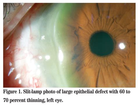 Wills Eye Resident Case Series