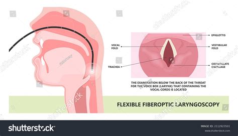 24 Otolaryngology Botox Images Stock Photos Vectors Shutterstock