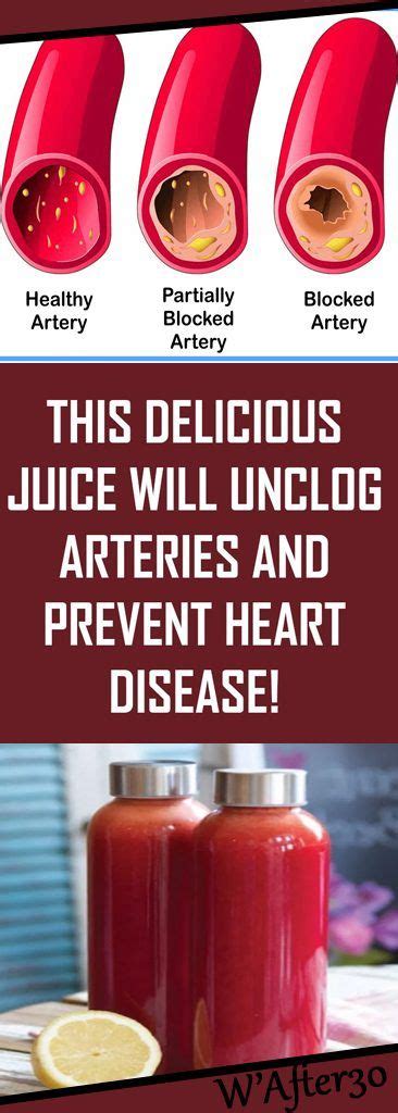 This Delicious Juice Will Unclog Arteries And Prevent Heart Disease