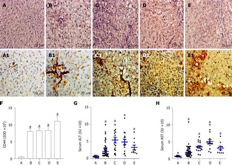 abnormal cd activation  hepatocytes  nonalcoholic fatty