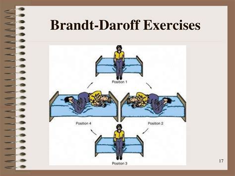 Bppv Brandt Daroff Exercises