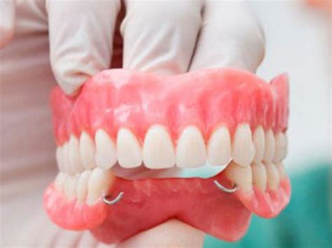 Qué son y cuántos tipos de prótesis dentales existen Guia Dental Mexicali