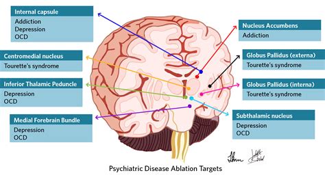 Psychological Disorders Brain