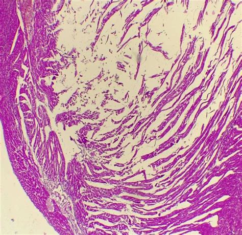 Histopathological Examination Of Heart Section Of Ct Group Showing