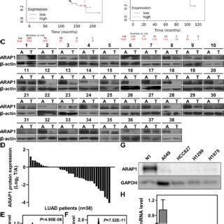 Ankyrin Repeat And Ph Domain Arap Is Frequently Down Regulated