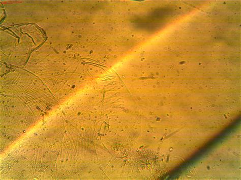 18 questions with answers in Cladocera | Science topic