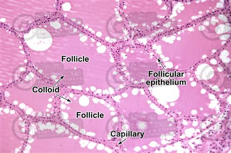 Man Thyroid Transverse Section X Man Mammals Endocrine