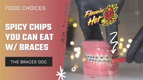 What Can You Eat With Braces Food Choices Spicy Flamin Hot Chips