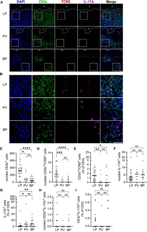 Frontiers Skin Infiltrating T Cells Display Distinct Inflammatory