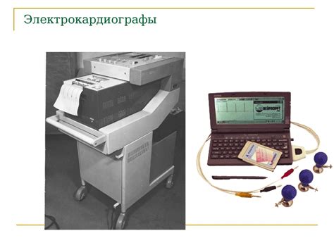 Электрокардиография. Метод регистрации электрической активности сердца ...