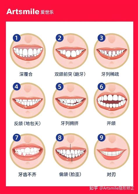 近七成中国孩子都有的“错颌畸形”，再不干预就晚了！ 知乎