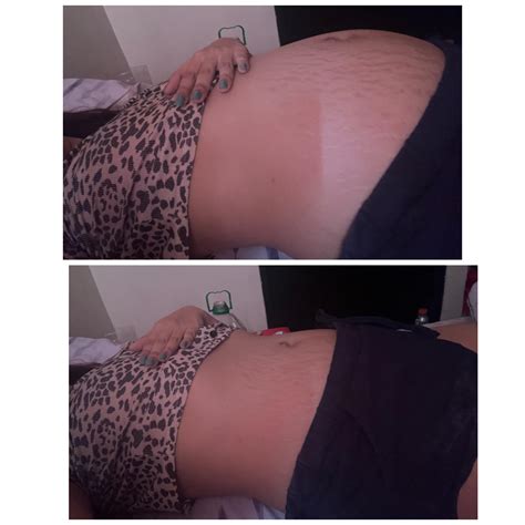 Bloat and Air Inflation : r/BellyInflationSpanish