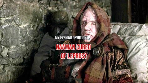 Naaman cured of leprosy - by Tony Silveira