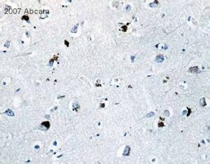 Anti-beta Amyloid antibody (ab2539) | Abcam