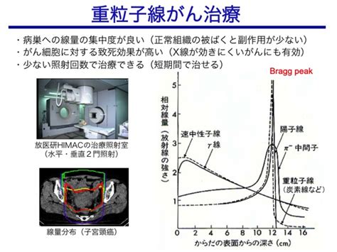 放射線の具体的な利用例5 北陸原子力懇談会（ほくげんこん）