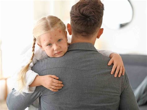 Febbre Alta Nei Bambini Quando Preoccuparsi E Cosa Fare Amico Pediatra