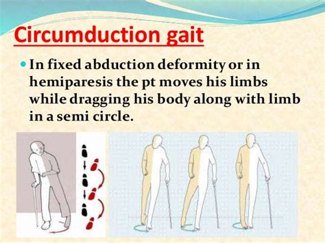 Examination Of Hip Joint