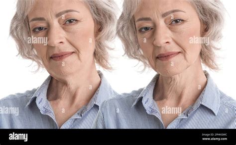 Double Chin Problem Collage With Photos Of Mature Woman Before And