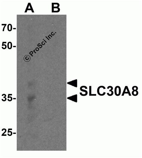 Slc A Antibody Cat No Prosci