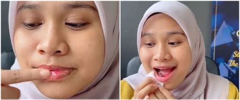 Tak Perlu Tambahan Petroleum Jelly Ini Trik Cerahkan Bibir Hitam Cuma