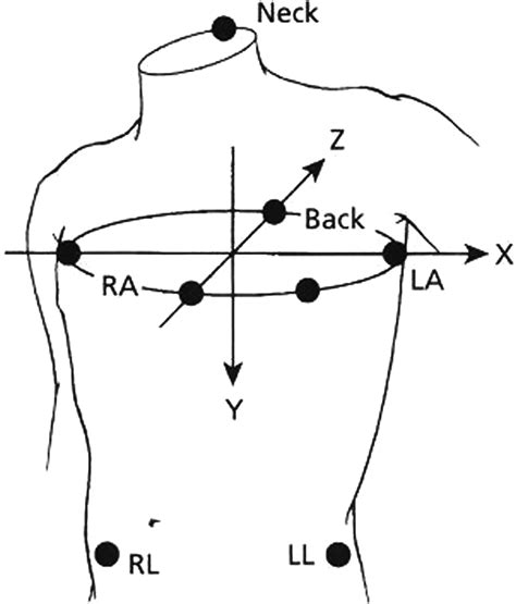 Holter Monitor 5 Lead Placement Diagram Wiring Diagram