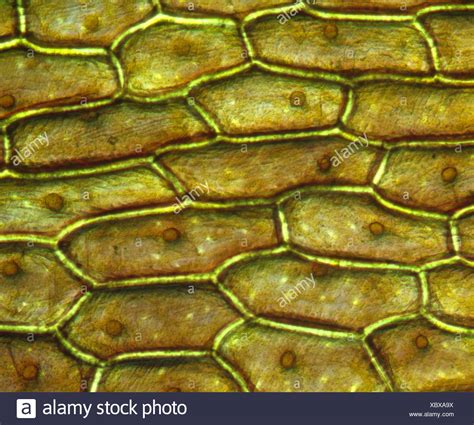 ONION SKIN CELLS (EPIDERMAL CELLS) SHOWS CELL STRUCTURE AND NUCLEUS STAINED IN IODINE / LIVE ...