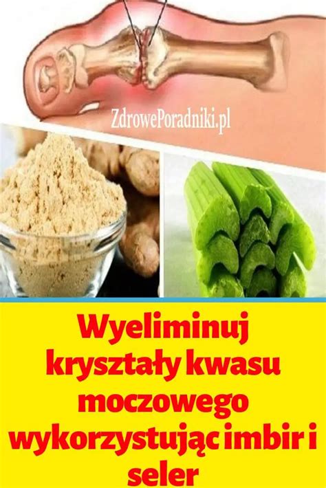 Wyeliminuj Kryszta Y Kwasu Moczowego Wykorzystuj C Imbir I Seler