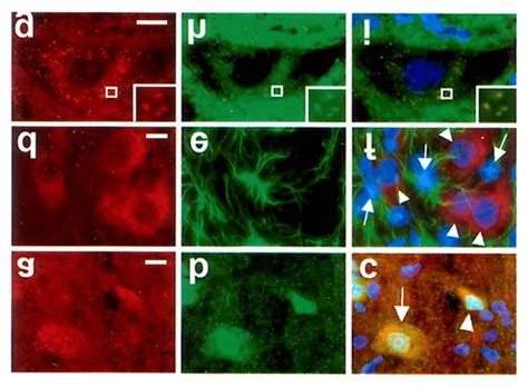 Fluorescent Double Labeling Of Ethidium And Neun A C Or Gfap D F Or