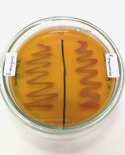 Enterobacter Cloacae: Facts, Symptoms, Treatment | STD.GOV Blog