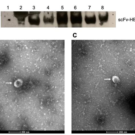 Characterization Of HER2 Specific HIV 1 Based VLPs Produced With