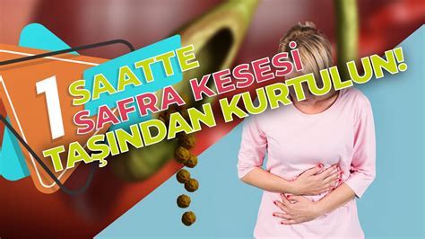 Safra Kesesi Ameliyat Olanlarin Yorumlar Estetik Rehberi