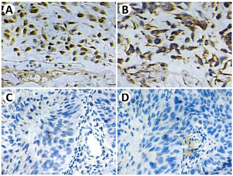 Representative Immunohistochemical Staining Of P16 And Pd L1 Download Scientific Diagram