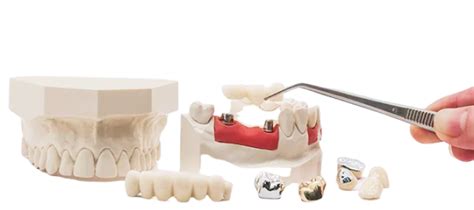 All Prosthesis – Easy Dent Dental | Website