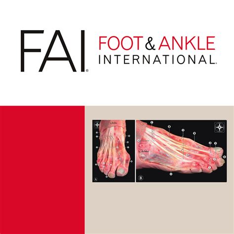 FAI September 2020 Comparison Between Polyvinyl Alcohol Implant And