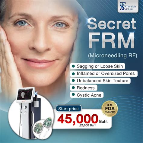 Secret Rf Microneedling Services To Reverse Aging And Remodel Your Skin S Collagen