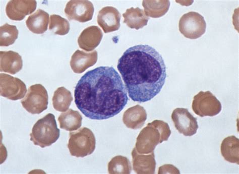 Monocyte Wikipedia