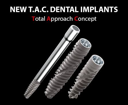 Aon Implants L Evoluzione Dell Implantologia Moderna