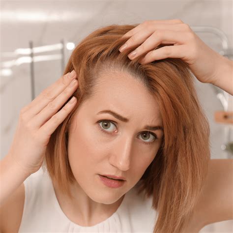 RECEDING HAIRLINE CAUSES AND TREATMENTS KERATIN HAIR TREATMENT