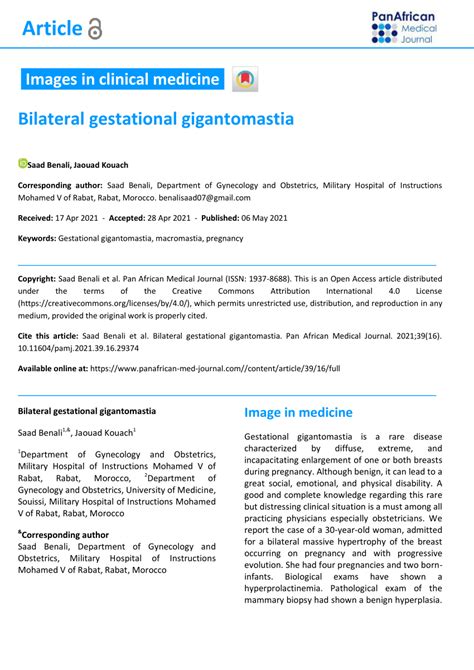 Pdf Bilateral Gestational Gigantomastia